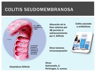 COLITIS SEUDOMEMBRANOSA

                             Alteración de la     Colitis asociada
                             flora colonica por    a antibióticos
                             AB permite el
                             sobrecrecimiento
                             por C. Difficile



                             Otros factores:
                             inmunosupresión




                         Otros:
 Clostridium Difficile   Salmonella, C.
                         Perfringes, S. aureus.
 