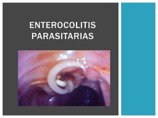 ENTEROCOLITIS
PARASITARIAS
 