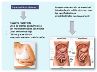 Características clínicas        La colectomia cura la enfermedad
                                      intestinal en la colitis ulcerosa, pero
                                      las manifestaciones
                                      extraintestinales pueden persistir.

-   Trastorno recidivante
-   Crisis de diarrea sanguinolenta
    con material mucoide con hebras
-   Dolor abdominal bajo
-   Cólicos que se alivian
    temporalmente con la defecación
 