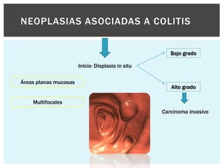 NEOPLASIAS ASOCIADAS A COLITIS


                                                      Bajo grado

                       Inicio: Displasia in situ

Áreas planas mucosas
                                                      Alto grado

    Multifocales
                                                   Carcinoma invasivo
 