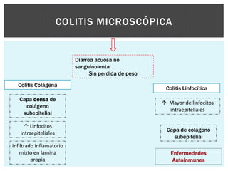 COLITIS MICROSCÓPICA


                          Diarrea acuosa no
                          sanguinolenta
                                Sin perdida de peso

  Colitis Colágena
                                                       Colitis Linfocítica
   Capa densa de
                                                      ↑ Mayor de linfocitos
     colágeno
                                                        intraepiteliales
    subepitelial

     ↑ Linfocitos
                                                        Capa de colágeno
   intraepiteliales
                                                          subepitelial
Infiltrado inflamatorio
    mixto en lamina                                      Enfermedades
         propia                                           Autoinmunes
 