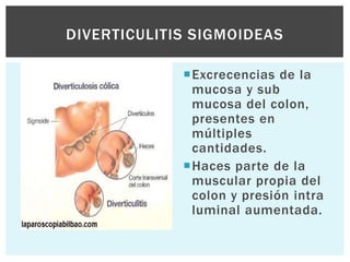 DIVERTICULITIS SIGMOIDEAS

             Excrecencias de la
              mucosa y sub
              mucosa del colon,
              presentes en
              múltiples
              cantidades.
             Haces parte de la
              muscular propia del
              colon y presión intra
              luminal aumentada.
 