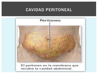 CAVIDAD PERITONEAL
 
