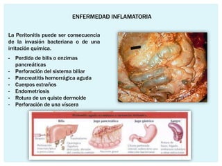 ENFERMEDAD INFLAMATORIA

La Peritonitis puede ser consecuencia
de la invasión bacteriana o de una
irritación química.
-   Perdida de bilis o enzimas
    pancreáticas
-   Perforación del sistema biliar
-   Pancreatitis hemorrágica aguda
-   Cuerpos extraños
-   Endometriosis
-   Rotura de un quiste dermoide
-   Perforación de una víscera
 