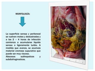 MORFOLOGÍA:




La superficie serosa y peritoneal
se vuelven mates y deslustradas y
a las 2 – 4 horas de infección
comienza a acumularse liquido
seroso o ligeramente turbio. A
medida que avanza, se acumula
material cremoso supurativo que
puede ser muy viscoso.
Abscesos      subhepaticos      y
subdiafragmaticos.
 