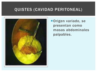 QUISTES (CAVIDAD PERITONEAL)

               Origen variado, se
                presentan como
                masas abdominales
                palpables.
 