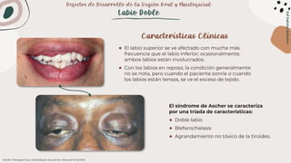 Labio Reposo Patologia 1. Cap 1 y 2.pptx