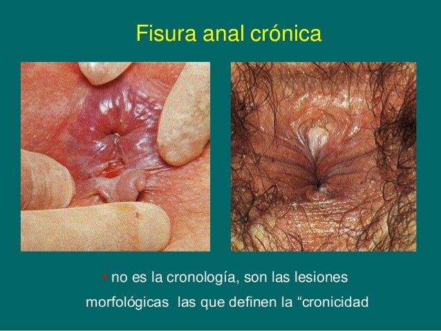 La red venosa sobre las mejillas