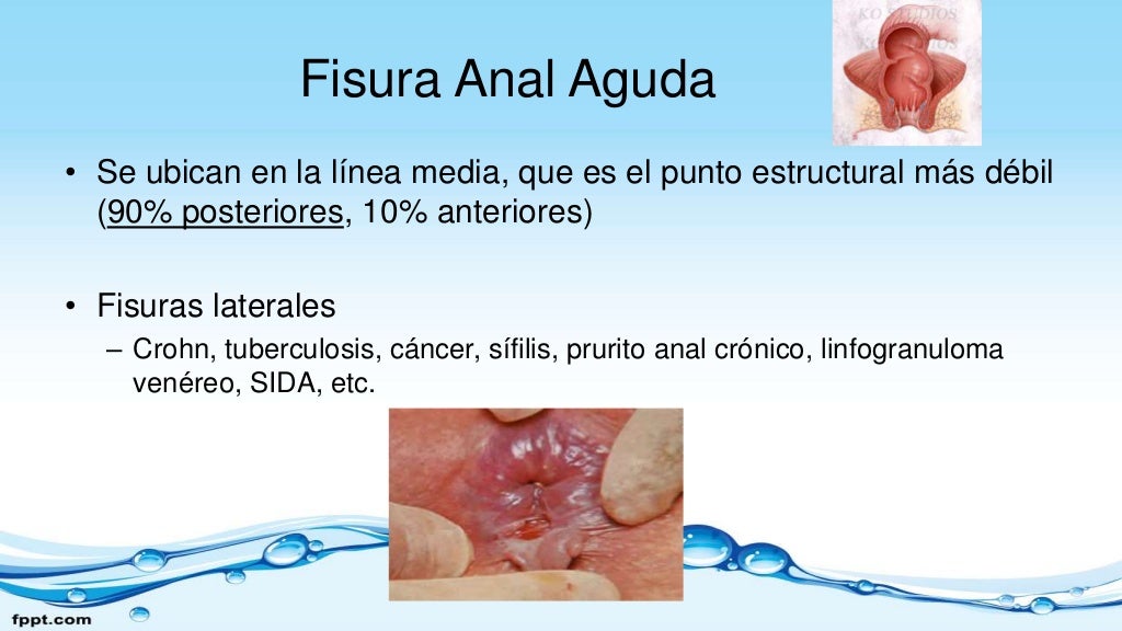 Patologia anorrectales