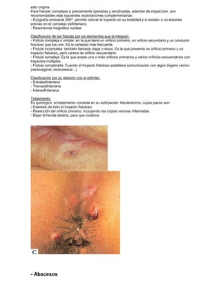 esto origina.
Para fístulas complejas o previamente operadas y recidivadas, además de inspección, son
recomendables elas siguientes exploraciones complementarias:
- Ecografía endoanal 360º: permite valorar el trayecto en su totalidad y si existen o no lesiones
previas en el complejo esfinteriano.
- Resonancia magnétca nuclear
Clasificación de las fístulas por los elementos que la integran:
- Fístula compleja o simple: en la que tiene un orificio primario, un orificio secundario y un conducto
fsituloso que los une. Es la variedad más frecuente.
- Fístula incompleta: también llamada ciega o sinus. Es la que presenta un orificio primario y un
trayecto fistuloso, pero carece de orificio secuandario.
- Fístula compleja: Es la que posee uno o más orificios primarios y varios orificios secuandarios con
trayectos múltiples.
- Fístula complicada: Cuando el trayecto fistuloso establece comunicación con algún órgano vecino
(rectovaginal, rectovesical...)
Clasificación por su relación con el esfínter:
- Extraesfinteriana
- Transesfinteriana
- Interesfinteriana
Tratamiento:
Es quirúrgico, el tratamiento consiste en su extirpación: fistulectomía, cuyos pasos son:
- Exéresis de todo el trayecto fistuloso
- Resección del orificio primario, incluyendo las criptas vecinas inflamadas.
- Dejar la herida abierta, para que cicatrice.
- Abscesos
 