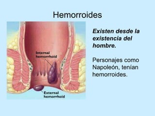 Patologia anorectales
