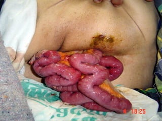 Patologia anorectales