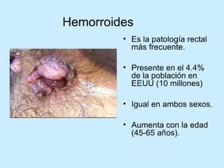 Patologia anorectales