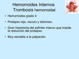 Patologia anorectales