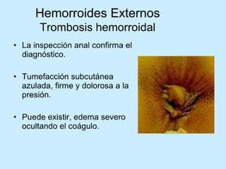 Patologia anorectales