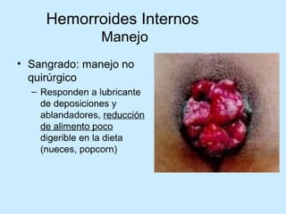 Patologia anorectales