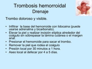 Patologia anorectales