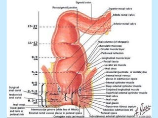 Patologia anorectales