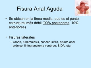 Patologia anorectales