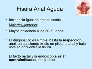 Patologia anorectales