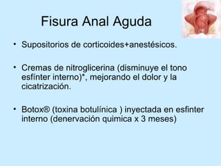 Patologia anorectales