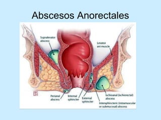 Patologia anorectales