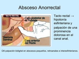 Patologia anorectales