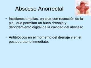 Patologia anorectales
