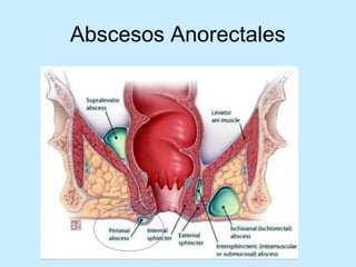 Patologia anorectales
