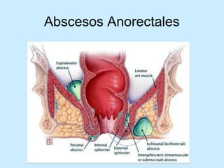 Patologia anorectales