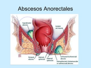 Patologia anorectales