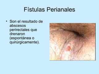 Patologia anorectales