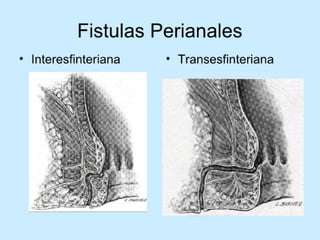 Patologia anorectales