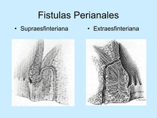 Patologia anorectales