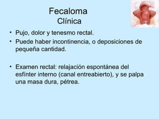 Patologia anorectales