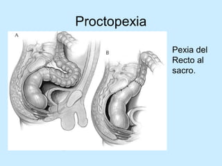 Patologia anorectales