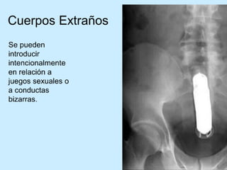 Patologia anorectales