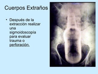 Patologia anorectales