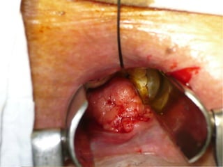 Patologia anorectales