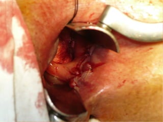 Patologia anorectales