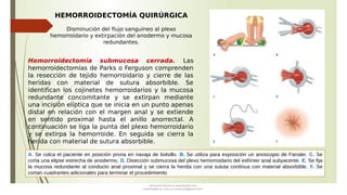 Patología DEL ANO Y RECTO PATOLOGIA ANORECTAL | PPT