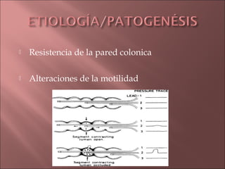    Resistencia de la pared colonica

   Alteraciones de la motilidad
 