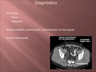 Diagnóstico

•Rx Simple
    •Tórax:
    •Abdomen


•Enema baritado y colonoscopia: contraindicados en fase aguda


•Enema hidrosoluble
 