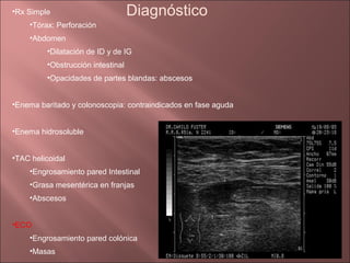 •Rx Simple                         Diagnóstico
    •Tórax: Perforación
    •Abdomen
         •Dilatación de ID y de IG
         •Obstrucción intestinal
         •Opacidades de partes blandas: abscesos


•Enema baritado y colonoscopia: contraindicados en fase aguda


•Enema hidrosoluble


•TAC helicoidal
    •Engrosamiento pared Intestinal
    •Grasa mesentérica en franjas
    •Abscesos


•ECO
    •Engrosamiento pared colónica
    •Masas
 