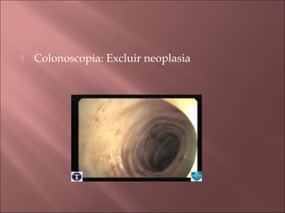    Colonoscopia: Excluir neoplasia
 