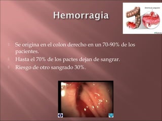    Se origina en el colon derecho en un 70-90% de los
    pacientes.
   Hasta el 70% de los pactes dejan de sangrar.
   Riesgo de otro sangrado 30%.
 