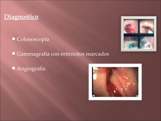 Diagnostico


     Colonoscopia

     Gammagrafía con eritrocitos marcados

     Angiografía
 