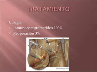 Cirugía:
 Inmunocomprometidos 100%

 Reoperación 3%
 