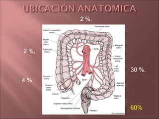 2 %.




2 %.


              30 %.
4%



              60%
 