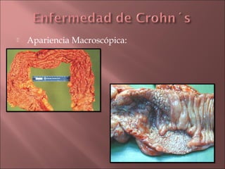    Apariencia Macroscópica:
 